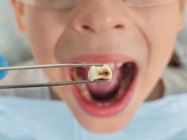Best Weekend Emergency Dental Services in Elkhart, KS